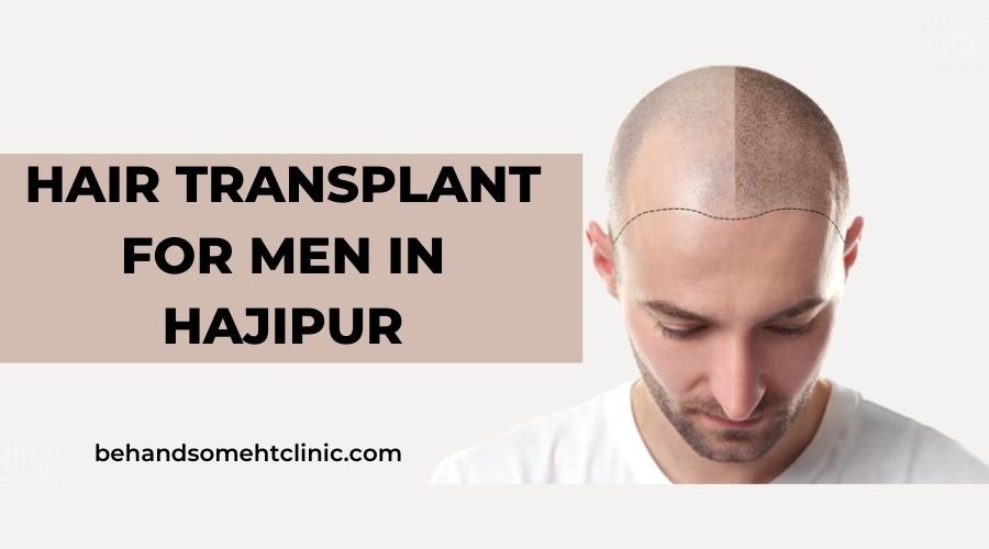 Hair Transplant For Men In Hajipur : Behandsome HT Clinic